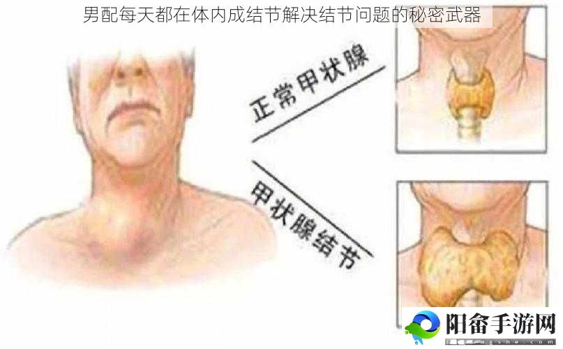 男配每天都在体内成结节解决结节问题的秘密武器